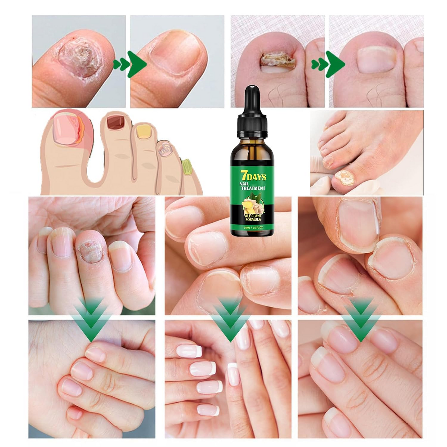 7-Day Nail Treatment Care Serum