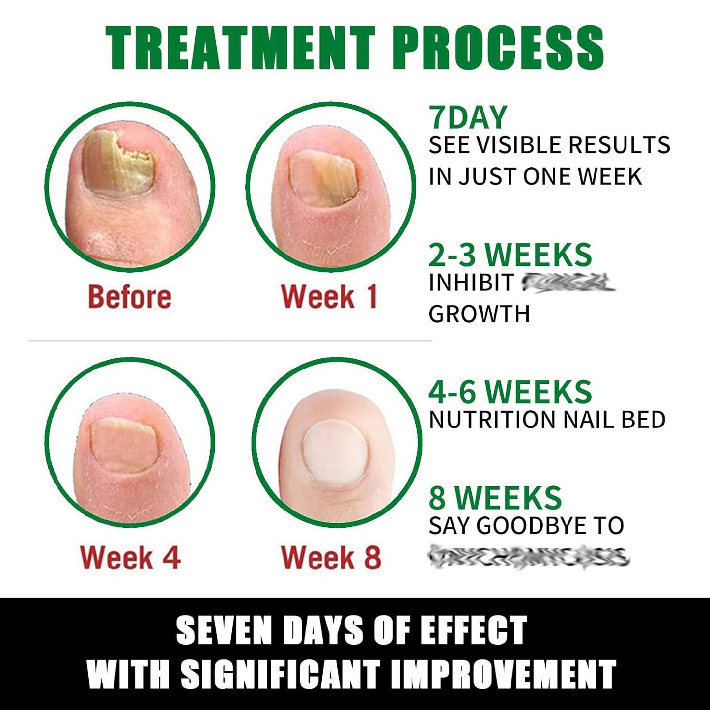 7-Day Nail Treatment Care Serum