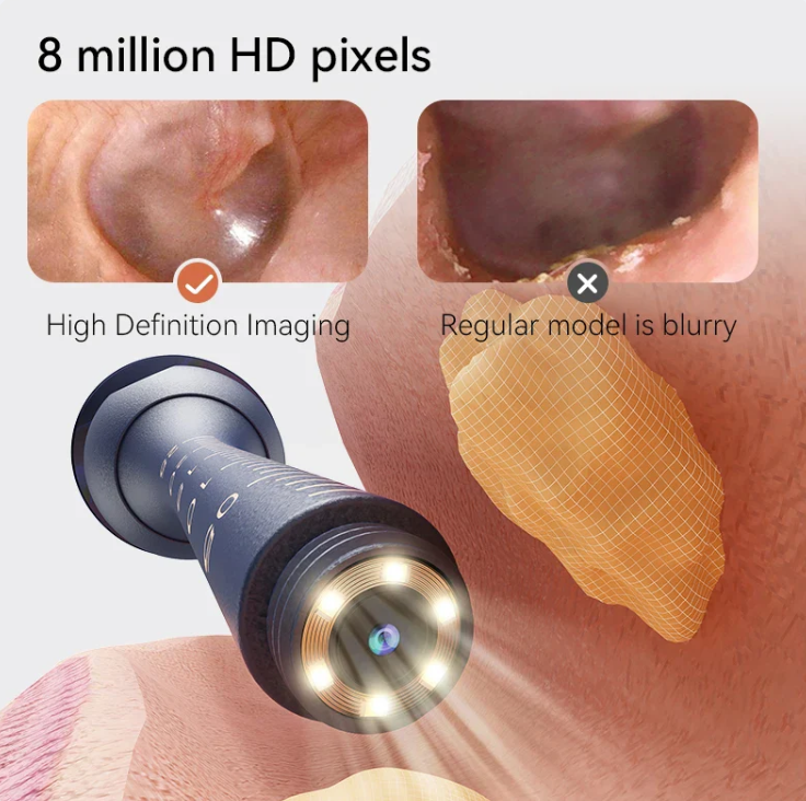 Ear Cleaning Camera - 14 Tools Kit